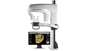 CS 9600 with 3D software provides all the tools we need for oral exams, dental implant planning, oral surgery, airway and TMJ analysis.